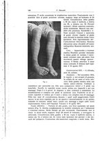 giornale/RML0015994/1918/unico/00000156