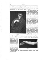 giornale/RML0015994/1918/unico/00000404