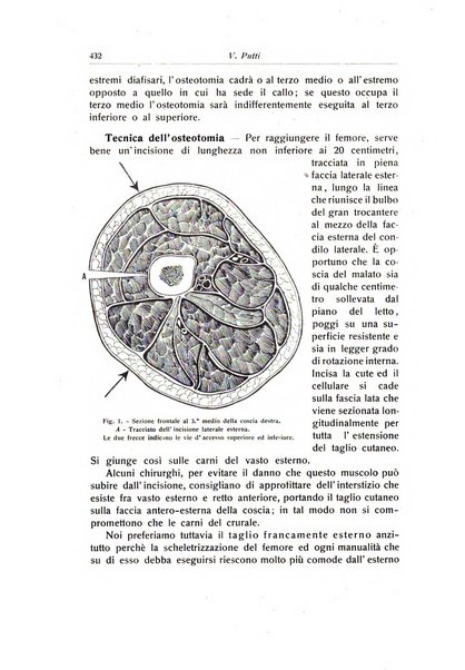 La chirurgia degli organi di movimento