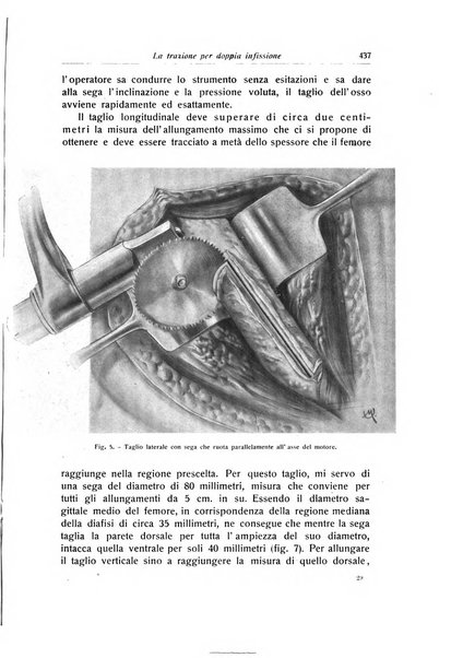 La chirurgia degli organi di movimento