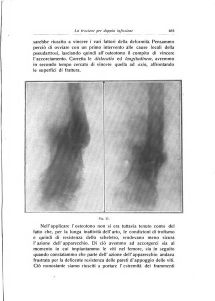 La chirurgia degli organi di movimento