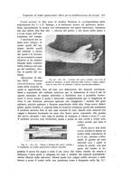 giornale/RML0015994/1918/unico/00000537