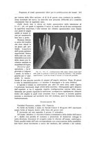 giornale/RML0015994/1918/unico/00000539