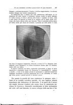 giornale/RML0015994/1918/unico/00000663