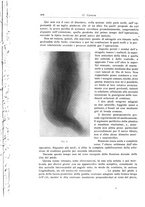 giornale/RML0015994/1919/unico/00000430