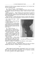 giornale/RML0015994/1920/unico/00000383