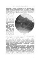 giornale/RML0015994/1922/unico/00000083