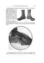 giornale/RML0015994/1922/unico/00000099