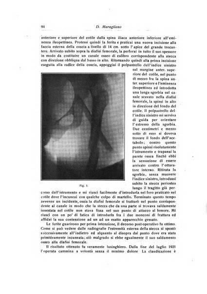 La chirurgia degli organi di movimento