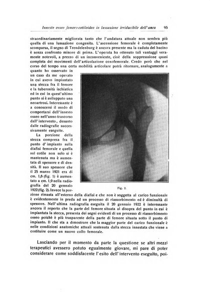 La chirurgia degli organi di movimento