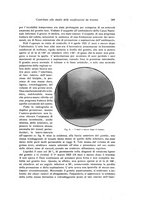 giornale/RML0015994/1922/unico/00000323