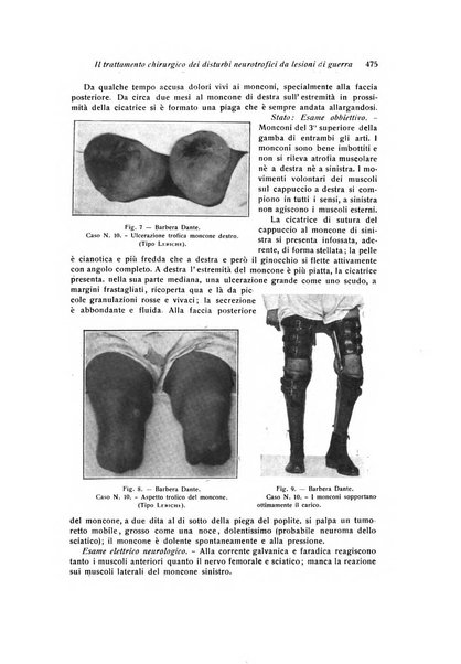 La chirurgia degli organi di movimento