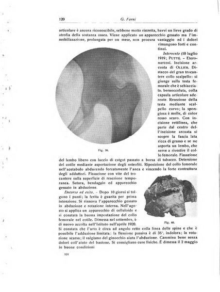 La chirurgia degli organi di movimento