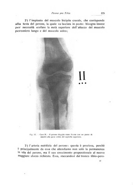 La chirurgia degli organi di movimento