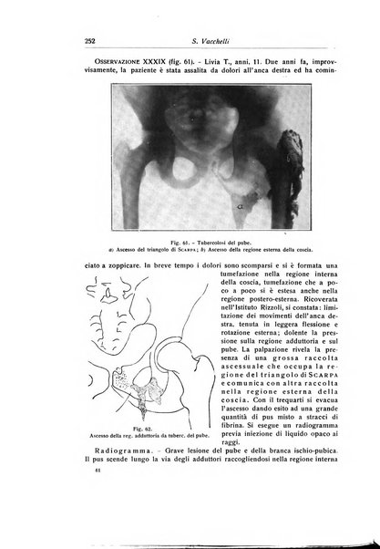 La chirurgia degli organi di movimento