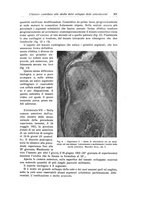 giornale/RML0015994/1923/unico/00000319