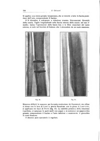 La chirurgia degli organi di movimento