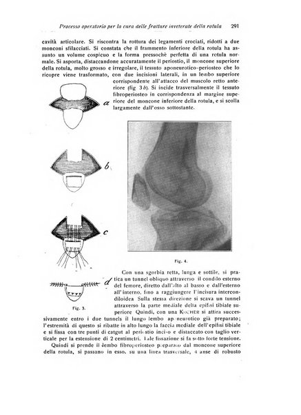 La chirurgia degli organi di movimento