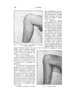 giornale/RML0015994/1924-1925/unico/00000322