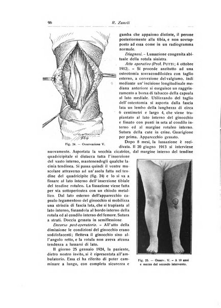 La chirurgia degli organi di movimento