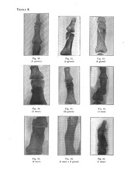 La chirurgia degli organi di movimento