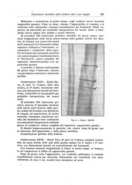 La chirurgia degli organi di movimento