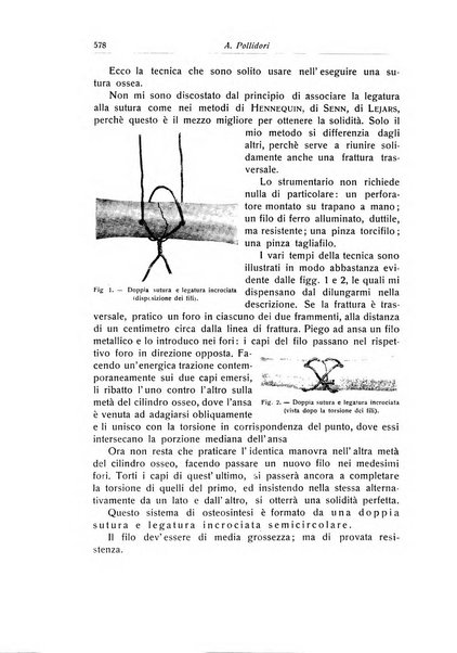 La chirurgia degli organi di movimento