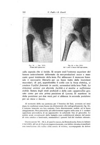 La chirurgia degli organi di movimento