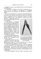 giornale/RML0015994/1928-1929/unico/00000123