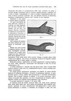 giornale/RML0015994/1928-1929/unico/00000177