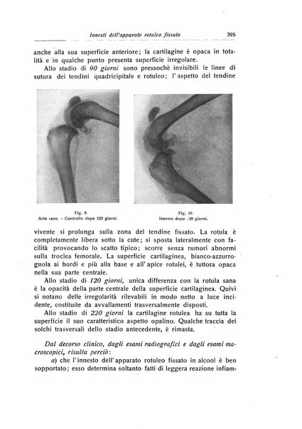 La chirurgia degli organi di movimento