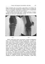 giornale/RML0015994/1928-1929/unico/00000439