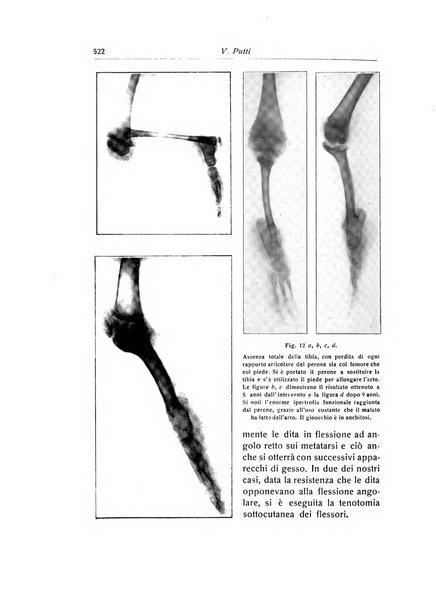 La chirurgia degli organi di movimento