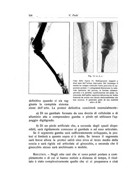 La chirurgia degli organi di movimento