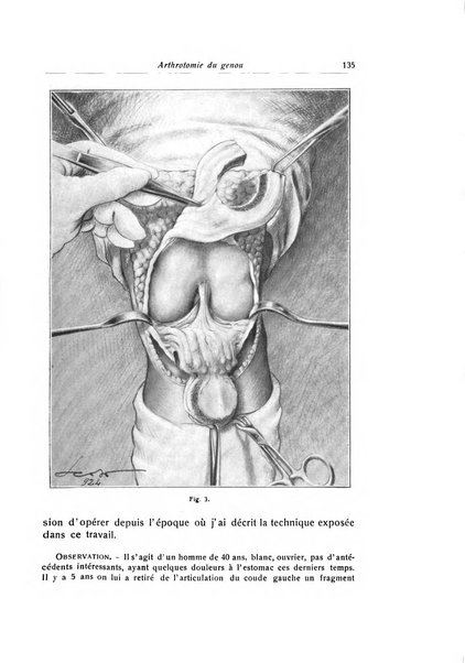 La chirurgia degli organi di movimento