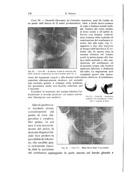 La chirurgia degli organi di movimento