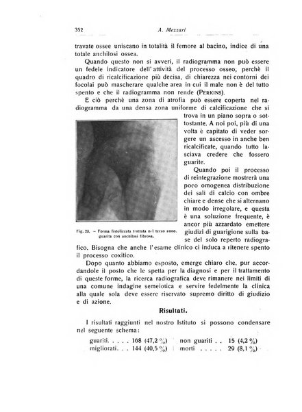 La chirurgia degli organi di movimento