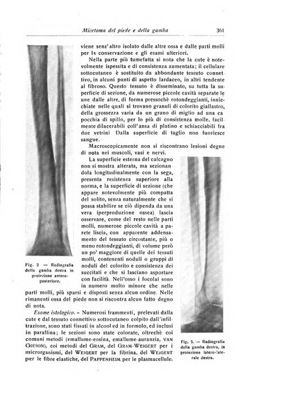 La chirurgia degli organi di movimento