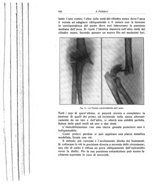 La chirurgia degli organi di movimento