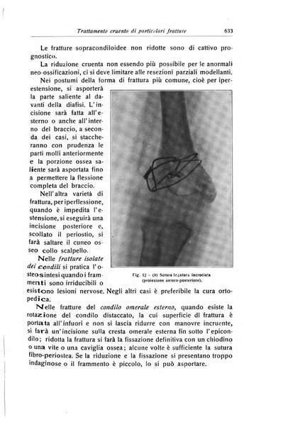 La chirurgia degli organi di movimento