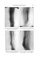 giornale/RML0015994/1930/unico/00000069