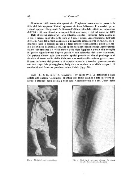 La chirurgia degli organi di movimento