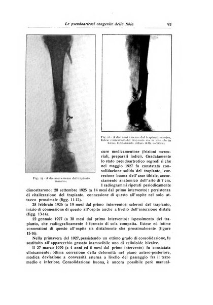 La chirurgia degli organi di movimento