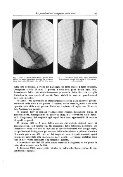 La chirurgia degli organi di movimento