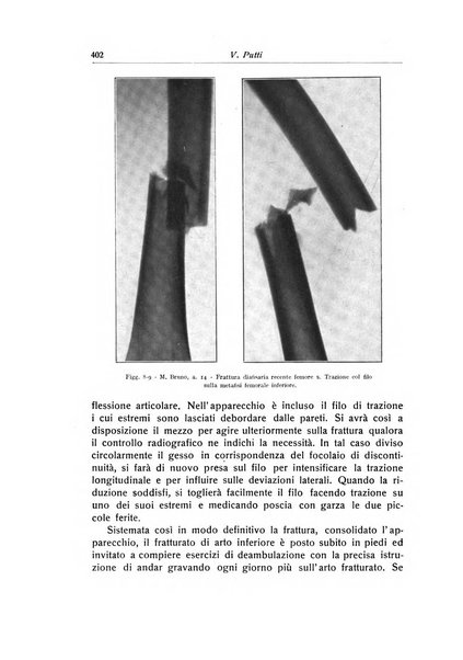 La chirurgia degli organi di movimento