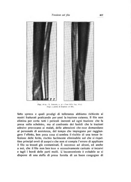 La chirurgia degli organi di movimento