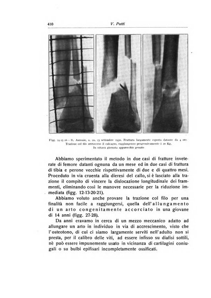 La chirurgia degli organi di movimento