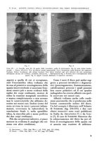 giornale/RML0015994/1933/unico/00000019