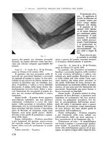 giornale/RML0015994/1934-1935/unico/00000192