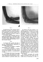 giornale/RML0015994/1934-1935/unico/00000193